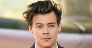 Harry Styles Hair Loss